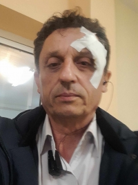 Επεισόδια με Ρομά σε Μέγαρα, Θήβα, Θεσσαλονίκη-Τραυματίστηκε ο δήμαρχος Αλιάρτου Γ.Ντασιώτης
