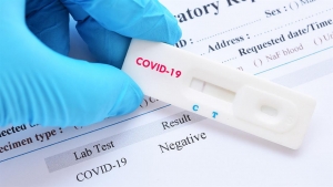 Self test:&Alpha;&pi;ό &tau;&iota;&sigmaf; 9 &Alpha;&pi;&rho;&iota;&lambda;ί&omicron;&upsilon; &delta;&iota;&alpha;&theta;έ&sigma;&iota;&mu;&alpha; &sigma;&tau;&alpha; &phi;&alpha;&rho;&mu;&alpha;&kappa;&epsilon;ί&alpha;-&Beta;ή&mu;&alpha; &pi;&rho;&omicron;&sigmaf; &beta;ή&mu;&alpha; &eta; &delta;&iota;&alpha;&delta;&iota;&kappa;&alpha;&sigma;ί&alpha;